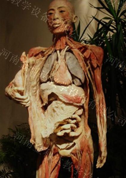 供应人体解剖塑化标本