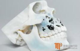 深圳义齿加工厂3d打印牙科3D打印批发