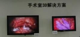 供应蛇牌3D腹腔镜录像系统